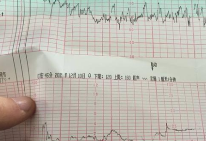 胎心音160次/分以上，怀孕39周请问胎心监护算正常吗房价从140万降到100万胎心音160次/分以上，怀孕39周请问胎心监护算正常吗 无线